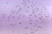 Candida albicans yeast cells, light micrograph