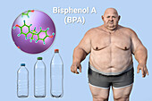 Link between plastics and obesity, conceptual illustration