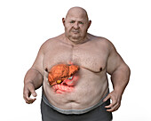 Fatty liver disease in an overweight man, illustration