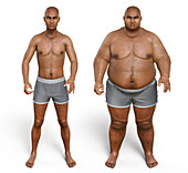 Man before and after gaining weight, illustration