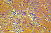 Candida albicans, light micrograph