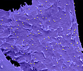 Murine leukaemia virus, SEM