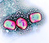 Mpox virus particles, TEM