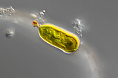 Ophiocytium sp. alga, light micrograph