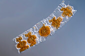 Odontella sp. algae, light micrograph
