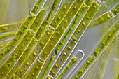 Gonatozygon kinahanii algae, light micrograph