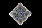 Diatom, light micrograph