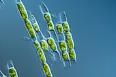 Tribonema algae, light micrograph