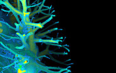 Healthy lung, CT scan