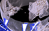 Paranasal sinuses, CT scan