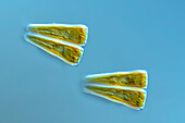 Gomphonema algae, light micrograph