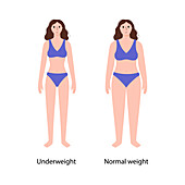 Underweight woman, illustration