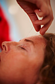 Woman Receiving Acupuncture