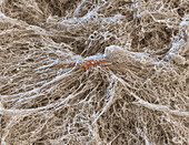 Fibroblast cell in collagen gel, SEM