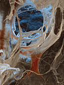 Human umbilical vein endothelial cell-derived cells, SEM