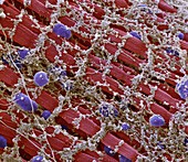 Muscle fibre, SEM