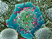 Macrophages infected with Streptococcus pyogenes, SEM