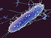 Bacteriophages attacking Pseudomonas aeruginosa bacterium, SEM