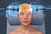 Electroconvulsive therapy, illustration