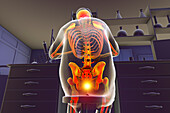 Sitting man with coccyx pain, conceptual illustration