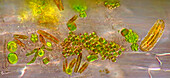 Das Bild zeigt verschiedene winzige Algen, die sich auf der Wurzel von Lemna sp. angesiedelt haben, fotografiert durch das Mikroskop in polarisiertem Licht bei einer Vergrößerung von 400X. Rechts sind Kieselalgen zu sehen, die in einer speziellen Schutzhülle eingeschlossen sind.