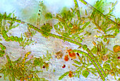 Das Bild zeigt verschiedene winzige Algen, die sich auf der Wurzel von Lemna sp. angesiedelt haben, aufgenommen durch das Mikroskop in polarisiertem Licht bei einer Vergrößerung von 200X