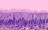 Testis epididymis, light micrograph