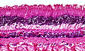 Human retina cells, light micrograph