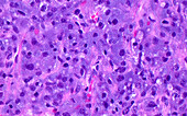 Adrenal medulla cells, light micrograph