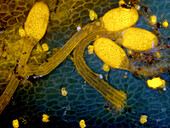 Sundew leaf with glandular hairs, light micrograph
