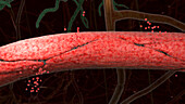 Damaged brain capillary, illustration