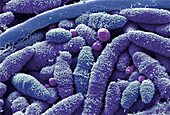 Tongue bacteria, SEM