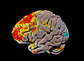 Resting brain, fMRI scan