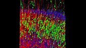 Nerve cells, confocal fluorescent micrograph