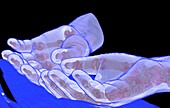 Hands and wrists, CT scan