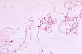 Rat bite fever bacteria, light micrograph