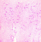 Human kidney, light micrograph