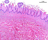 Human tongue filiform papillae, light micrograph