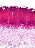 Skin on sole of the foot, light micrograph