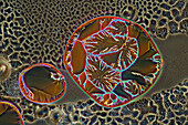 Hydroquinone and resorcinol crystals, light micrograph