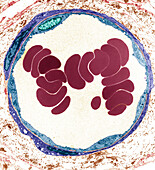 Arteriole, TEM