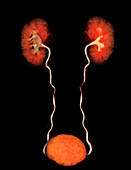Urinary system, CT scan