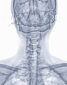 Head and neck bones, X-ray