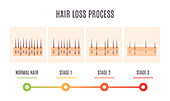 Hair loss process, conceptual illustration