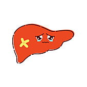 Liver disease, conceptual illustration