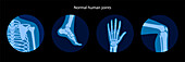 Healthy joints, illustration