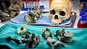 Forensic analysis of human remains