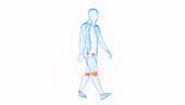 Joint pain while walking, illustration