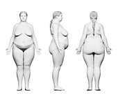 Obese female body, illustration