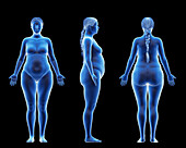 Overweight female body, illustration